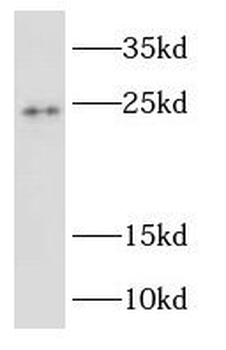 RAB2B Rabbit Polyclonal Antibody