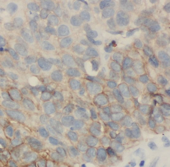 RAB32 Rabbit Polyclonal Antibody