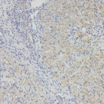 RAB34 Antibody