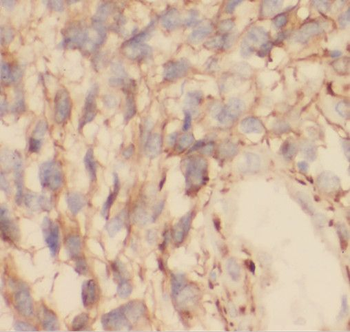 RAB5A Specific Rabbit Polyclonal Antibody