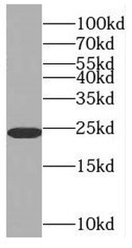 RAB6A Rabbit Polyclonal Antibody