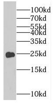 RAB8B Rabbit Polyclonal Antibody
