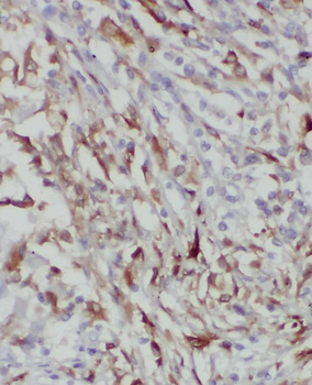 RAB8B Rabbit Polyclonal Antibody