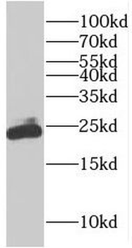 RAB9A Rabbit Polyclonal Antibody