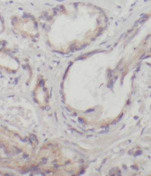RAB9A Rabbit Polyclonal Antibody
