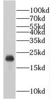 RABAC1 Rabbit Polyclonal Antibody