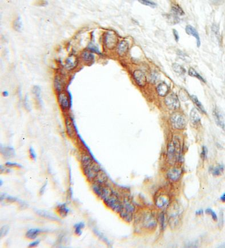 RABAC1 Rabbit Polyclonal Antibody