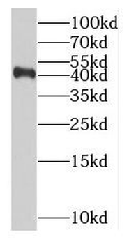 RABEPK Rabbit Polyclonal Antibody