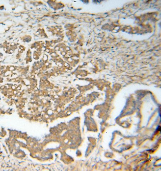 RABEPK Rabbit Polyclonal Antibody