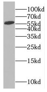 RABGEF1 Rabbit Polyclonal Antibody