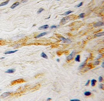 RABGEF1 Rabbit Polyclonal Antibody