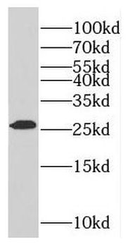 RABL2A Rabbit Polyclonal Antibody