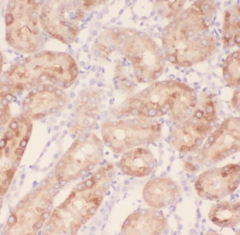 RABL2A Rabbit Polyclonal Antibody