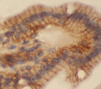 RAC1 Rabbit Polyclonal Antibody
