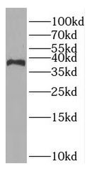 Rad51ap1 Antibody