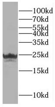 RAD51D Antibody