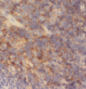 RAD51D Antibody