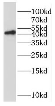 RAD51B Antibody
