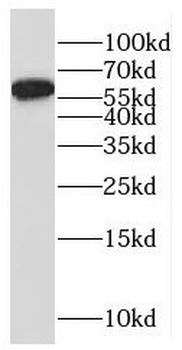 RAG2 Rabbit Polyclonal Antibody