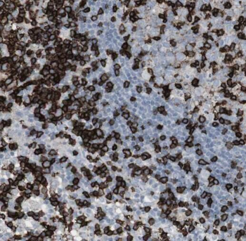 RAG2 Rabbit Polyclonal Antibody