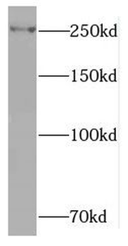 RAI1 Rabbit Polyclonal Antibody