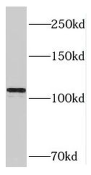 RAI14 Rabbit Polyclonal Antibody