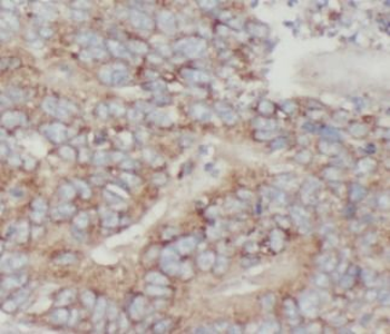 CRADD Rabbit Polyclonal Antibody