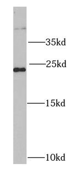 RALB Rabbit Polyclonal Antibody