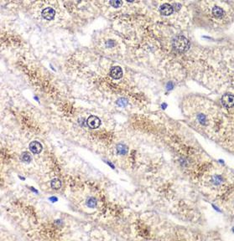 RALB Rabbit Polyclonal Antibody