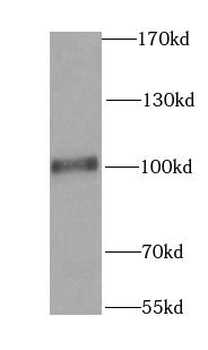 RALBP1 Rabbit Polyclonal Antibody