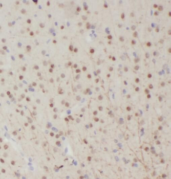 RALYL Antibody