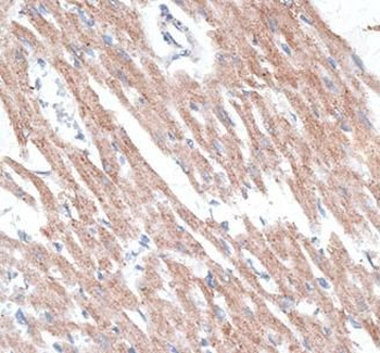RAMP1 Antibody