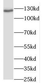 RANBP6 Rabbit Polyclonal Antibody