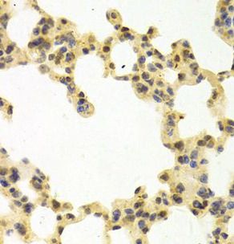 RANGAP1 Antibody