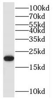 RAP2A Rabbit Polyclonal Antibody