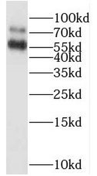 RAPGEFL1 Rabbit Polyclonal Antibody