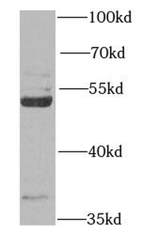 RAPSN Rabbit Polyclonal Antibody