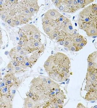 RAPSN Rabbit Polyclonal Antibody