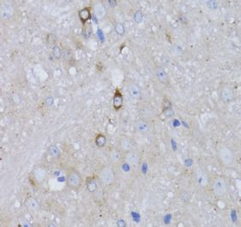 RARA Rabbit Polyclonal Antibody