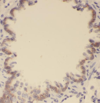 PLAAT4 Antibody