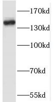 RASAL2 Rabbit Polyclonal Antibody