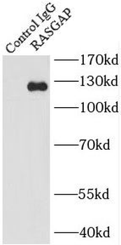 RASA1 Rabbit Polyclonal Antibody