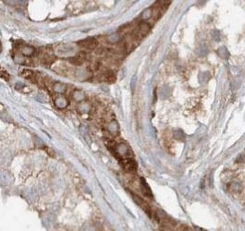 RASA1 Rabbit Polyclonal Antibody