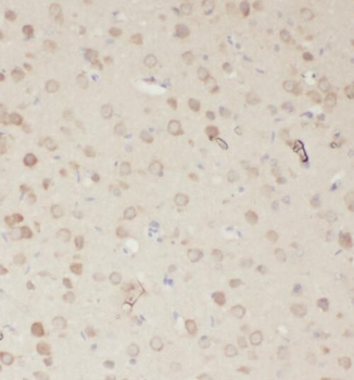 RASGEF1A Rabbit Polyclonal Antibody