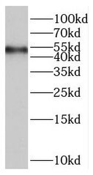 RASGRP2 Rabbit Polyclonal Antibody