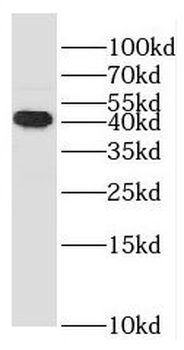RASSF6 Rabbit Polyclonal Antibody