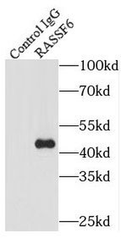 RASSF6 Rabbit Polyclonal Antibody