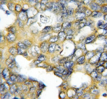 RASSF6 Rabbit Polyclonal Antibody