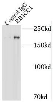 RB1CC1 Rabbit Polyclonal Antibody