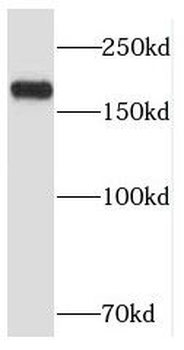 RB1CC1 Rabbit Polyclonal Antibody
